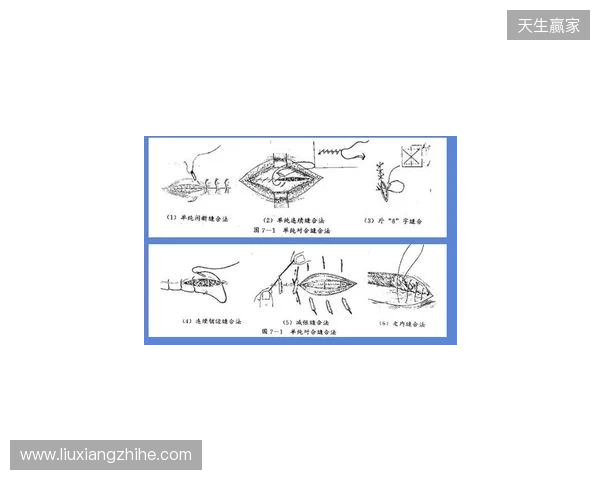 广州豹官方：杨浩眉弓伤口缝合30余针，预计5-7天后拆线